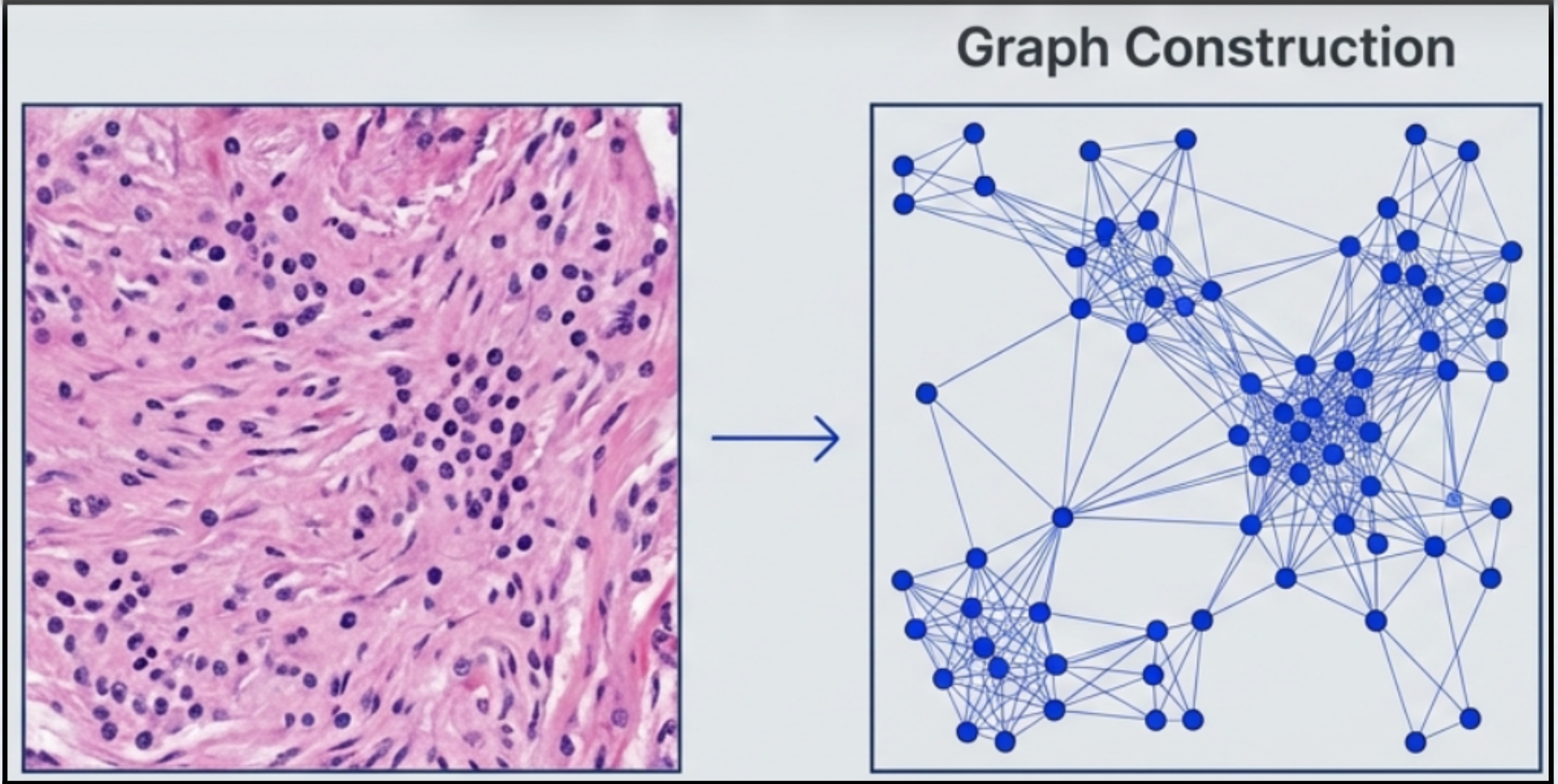 Graph Attention U-Net Architecture